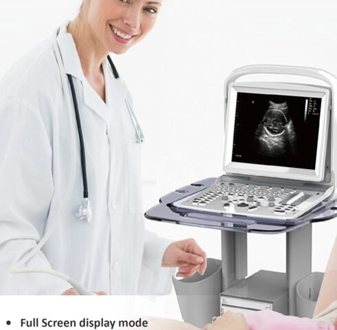 prenosný ultrazvukový prístroj